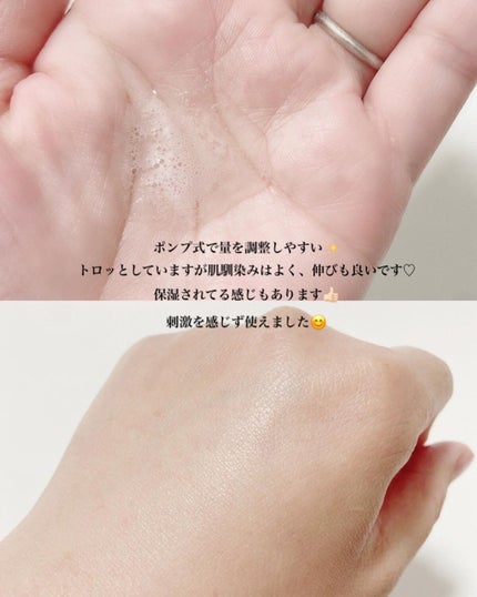 潤浸保湿 化粧水 III とてもしっとり/キュレル/化粧水を使ったクチコミ(4枚目)