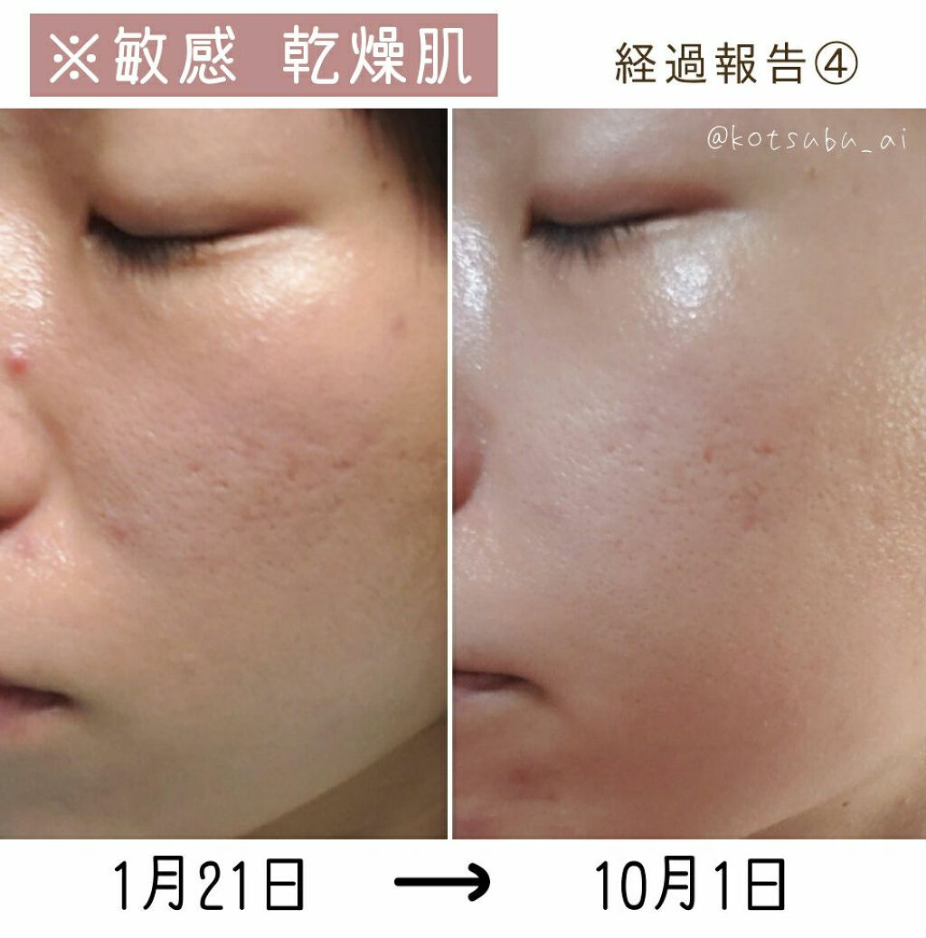 クリーム UFC/Kiehl's/フェイスクリームを使ったクチコミ（2枚目）