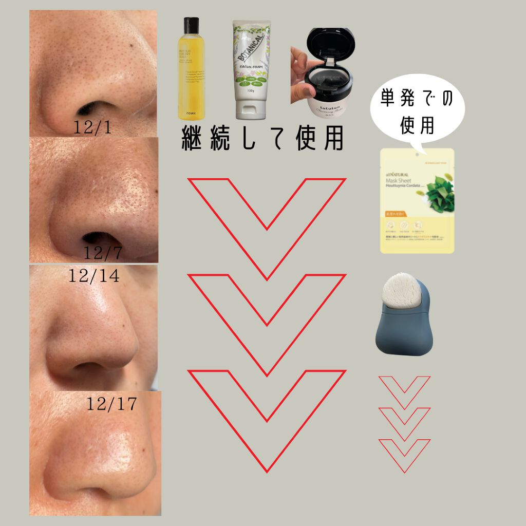 フルフィットプロポリスシナジートナー/COSRX/化粧水を使ったクチコミ(3枚目)