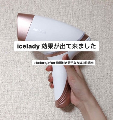 アイスレディ｜iceladyの効果に関する口コミ - icelady 効果が出てき ...