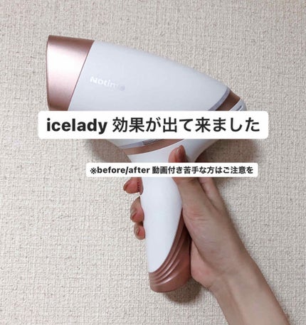 アイスレディ/icelady/家庭用脱毛器を使ったクチコミ(1枚目)