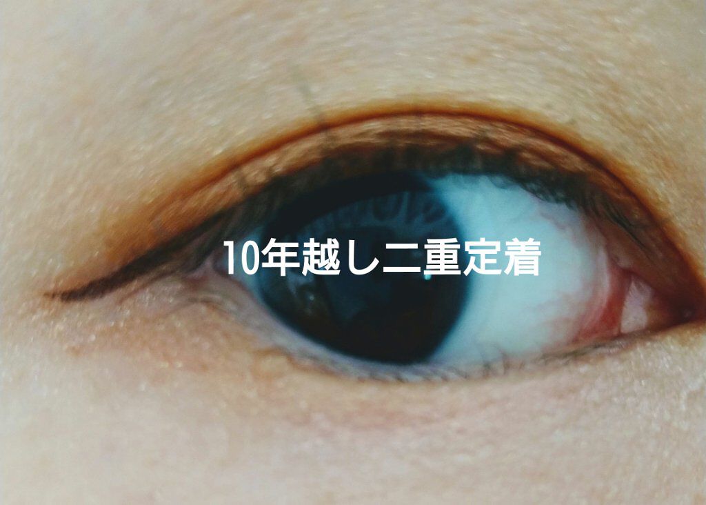 シングルアイテープ/Automatic Beauty/二重まぶた用アイテムを使ったクチコミ（1枚目）