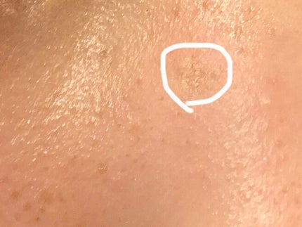 ビューティー カバーペンシル スリム-1/三善/ペンシルコンシーラーを使ったクチコミ(3枚目)