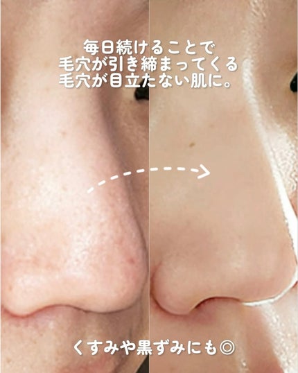 ピンクアロエメレンゲクレンザー/APRILSKIN/その他洗顔料を使ったクチコミ(7枚目)