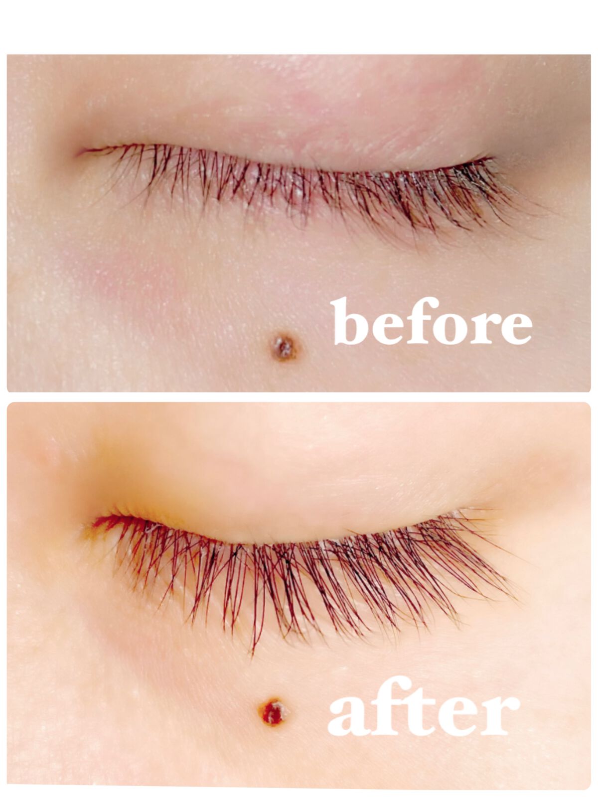 アイラッシュセラム/PHOEBE BEAUTY UP/まつげ美容液を使ったクチコミ(1枚目)