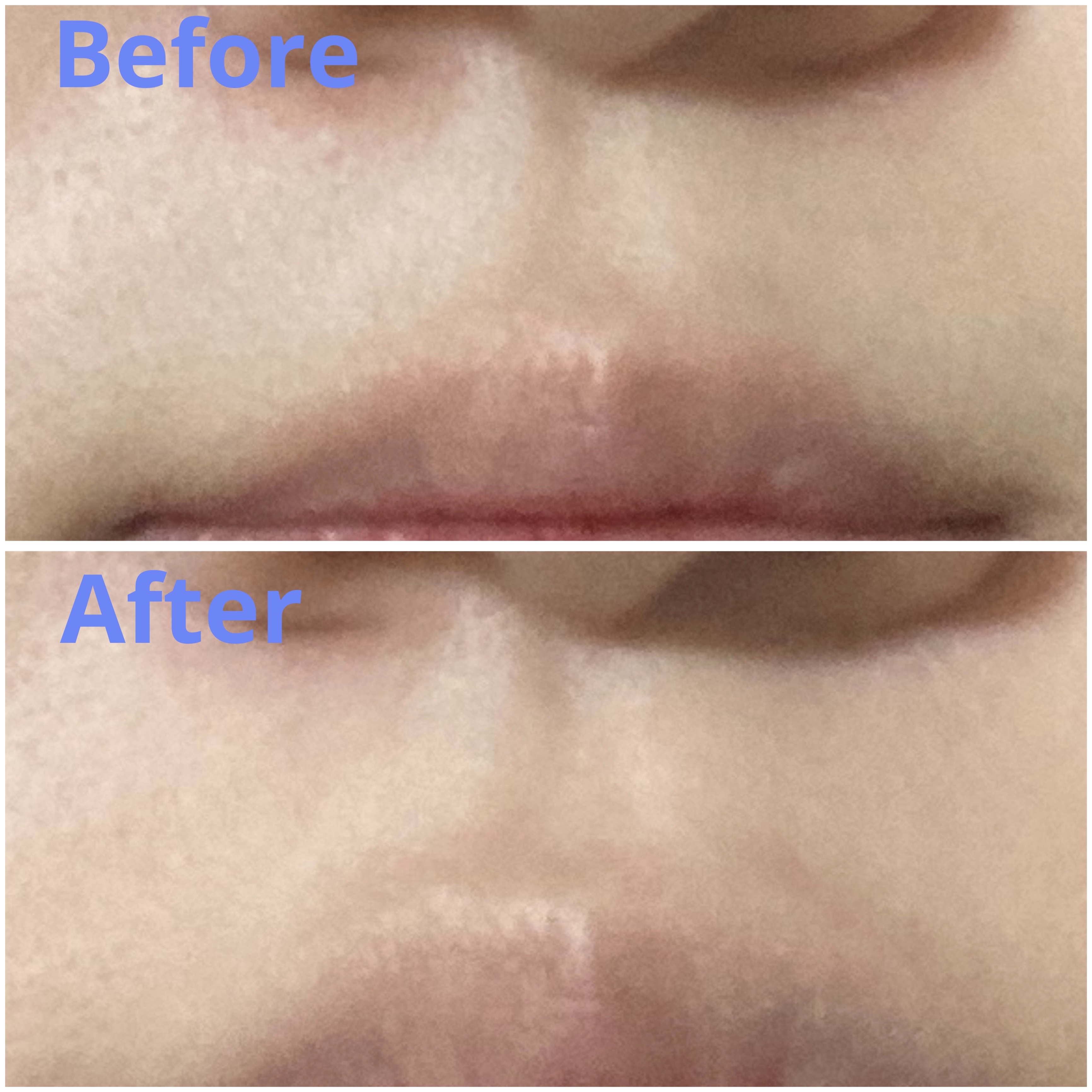 リシェ レッドトリック アイコンシーラー/Visée/パレットコンシーラーを使ったクチコミ（3枚目）