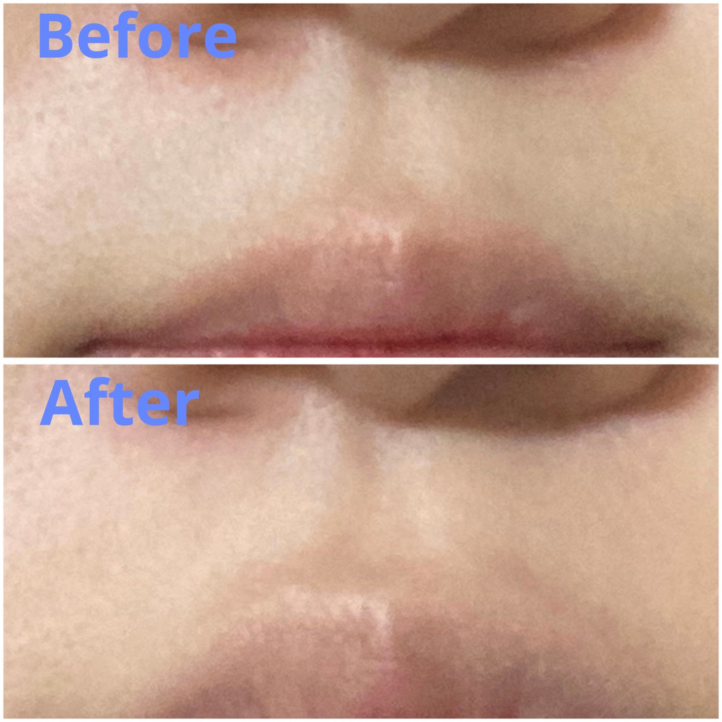 リシェ レッドトリック アイコンシーラー/Visée/パレットコンシーラーを使ったクチコミ(3枚目)