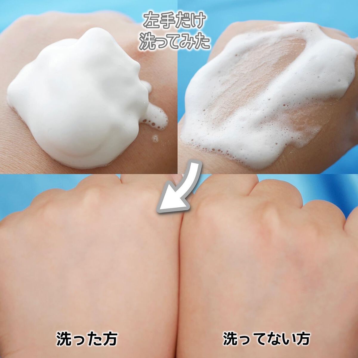 炭酸クレンジング/肌ナチュール/泡洗顔を使ったクチコミ（2枚目）