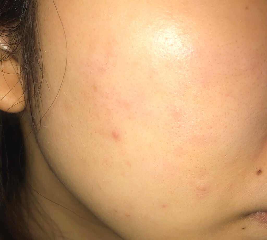 ホワイトアップ ローション(II)/アクアレーベル/化粧水を使ったクチコミ（3枚目）