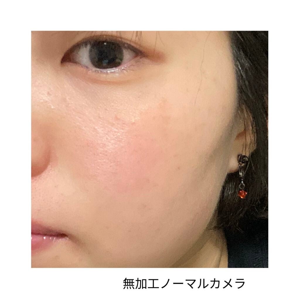 ティーツリーケア ソリューション エッセンシャルマスクEX/MEDIHEAL/シートマスク・パックを使ったクチコミ(4枚目)