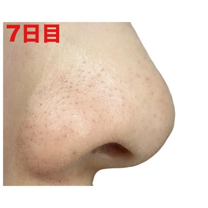 3番 緑茶炭毛穴パッククレンジングバーム/numbuzin/クレンジングバームを使ったクチコミ(10枚目)