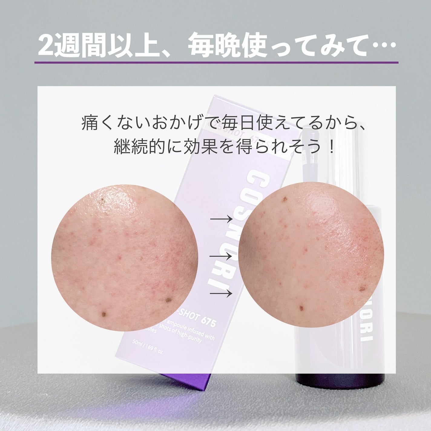 パンテショット675/COSNORI/美容液を使ったクチコミ(6枚目)