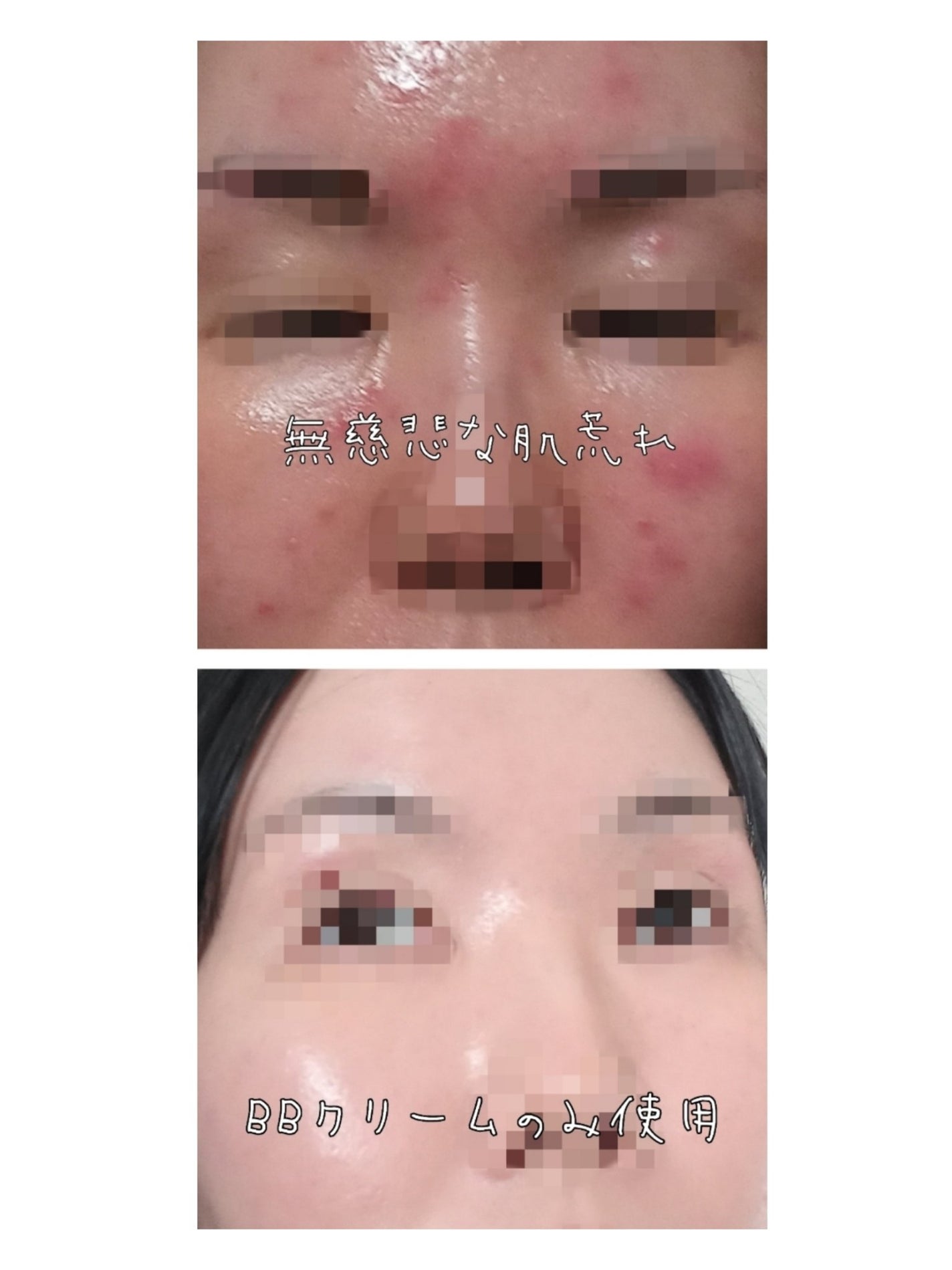 スキンブレミッシュバーム/Cell Fusion C(セルフュージョンシー)/化粧下地を使ったクチコミ(2枚目)