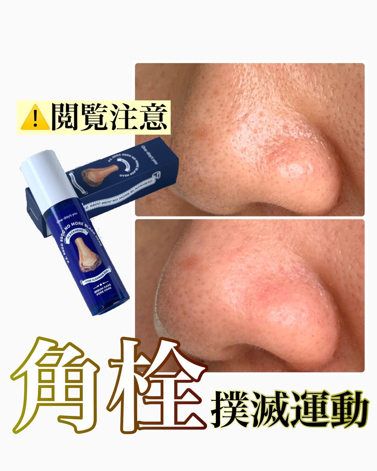 ãã¿ããðæçš¿ããæ¹ãã©ããã on LIPS ãQ10ã®ã¡ã¬å²ã§èŠã€ããŠæãããã±è²·ããããã¡ããããŒã¢ã¢ãã©..ãïŒ1æç®ïŒ