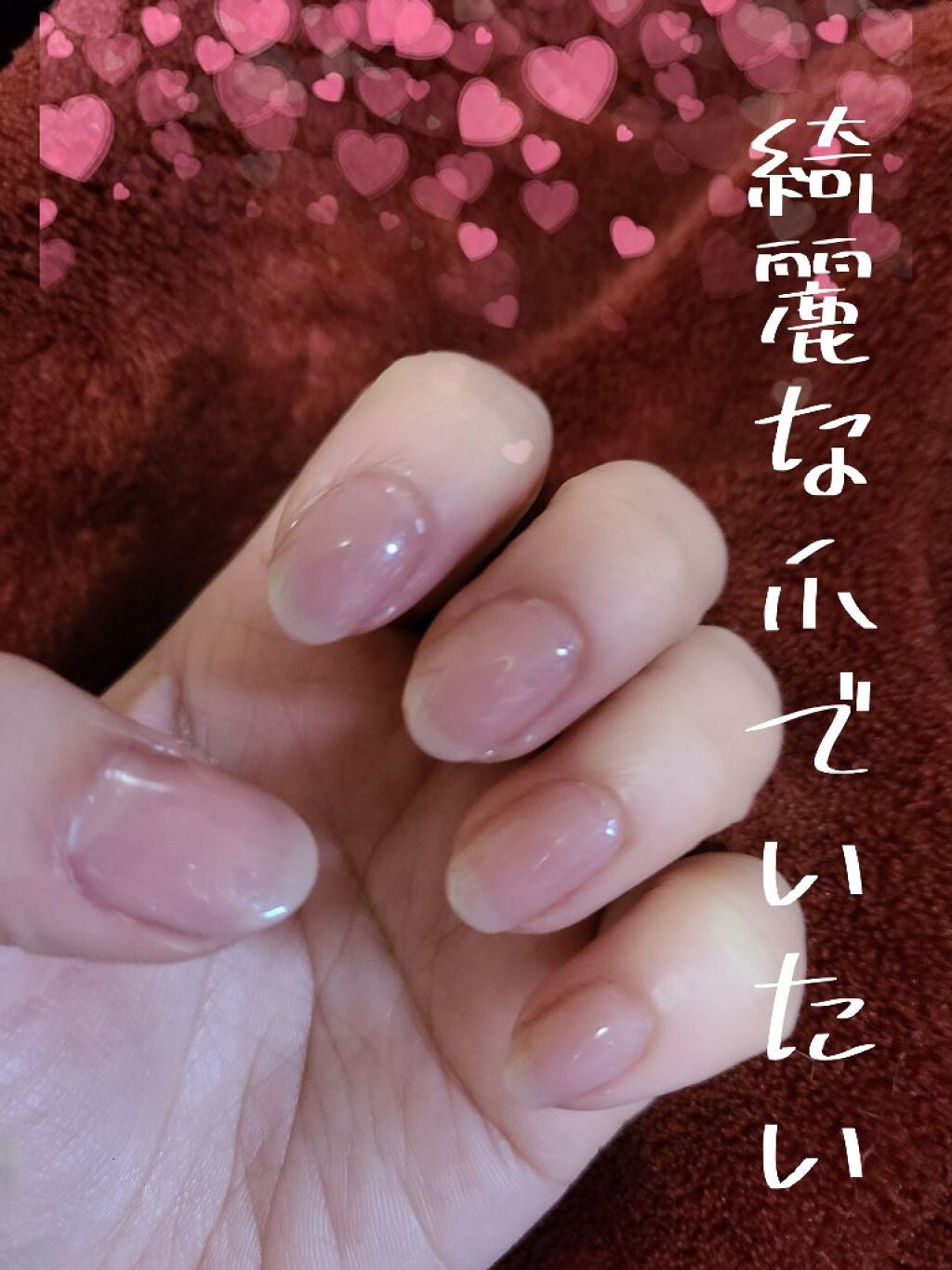 ネイルエンビー/O・P・I/ネイルオイル・トリートメントを使ったクチコミ(1枚目)