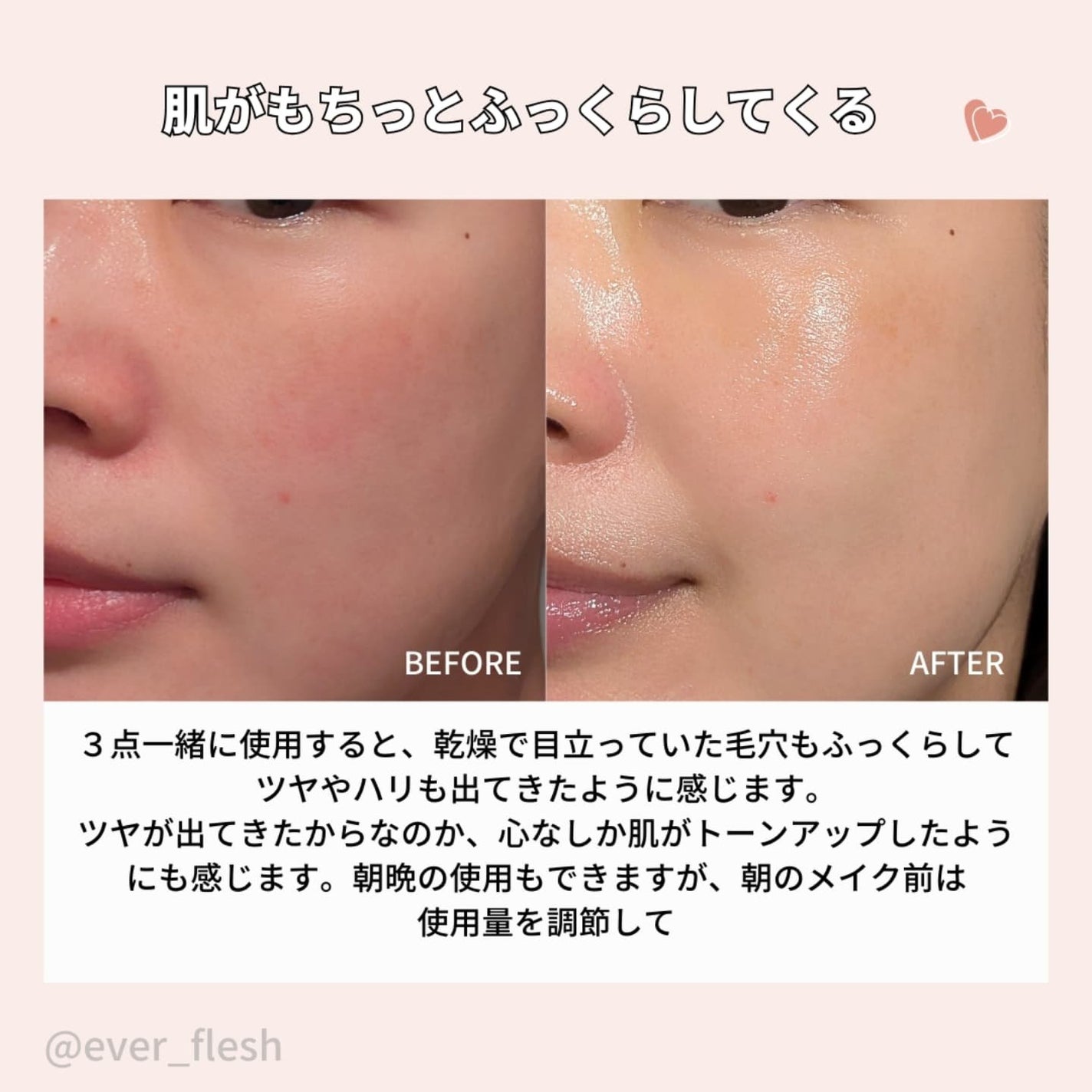 イージーエフタイムリカバリーマイクロエッセンス/Bonajour/美容液を使ったクチコミ(6枚目)