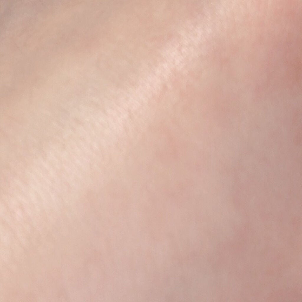 リムヴェール LSピュア/リムサプライ/美容液を使ったクチコミ(3枚目)