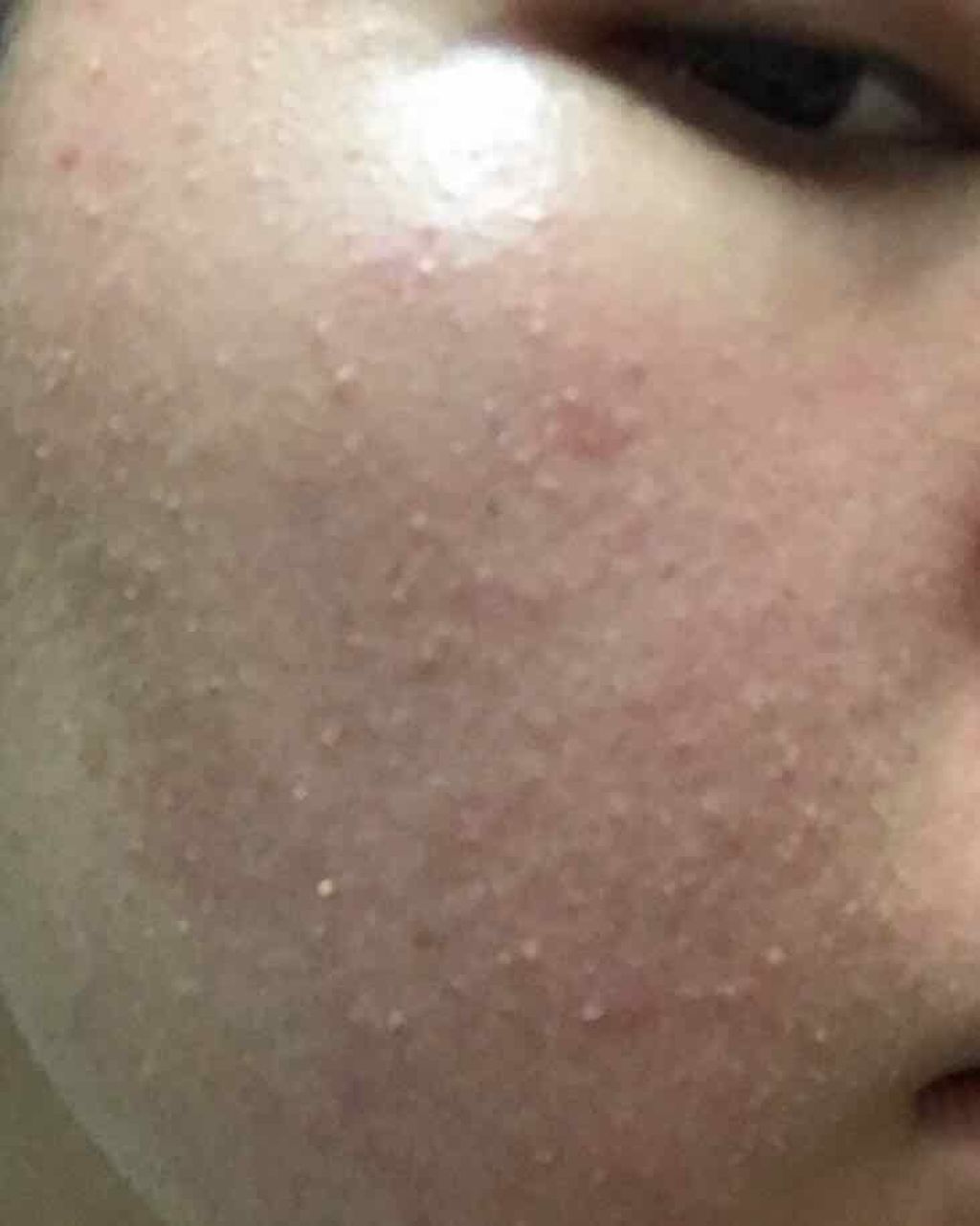 ホワイトアップ ローション(II)/アクアレーベル/化粧水を使ったクチコミ（3枚目）