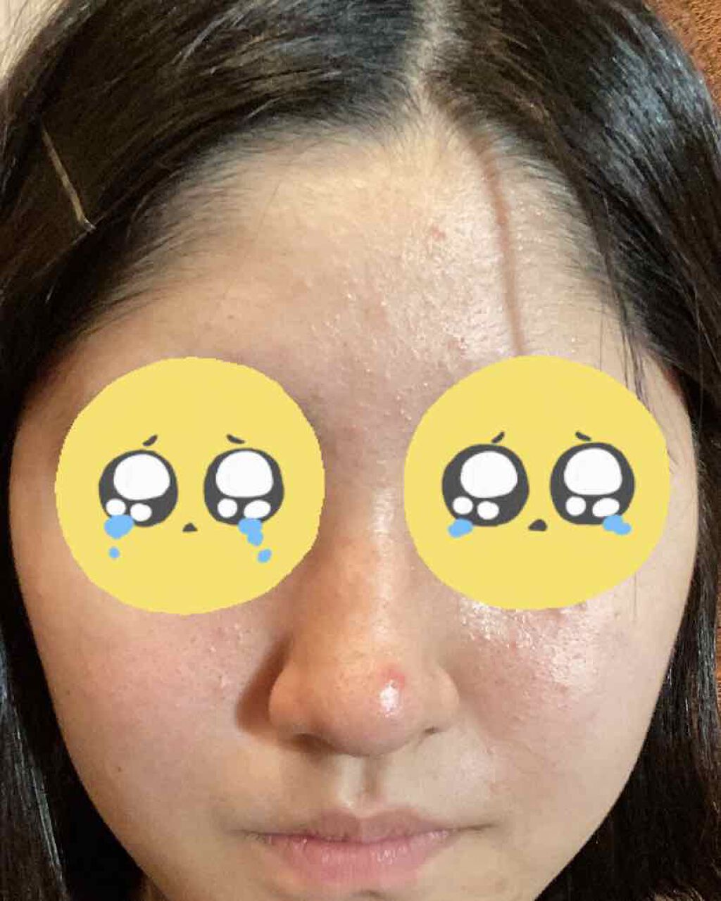 薬用保湿化粧水/オードムーゲ/化粧水を使ったクチコミ（2枚目）