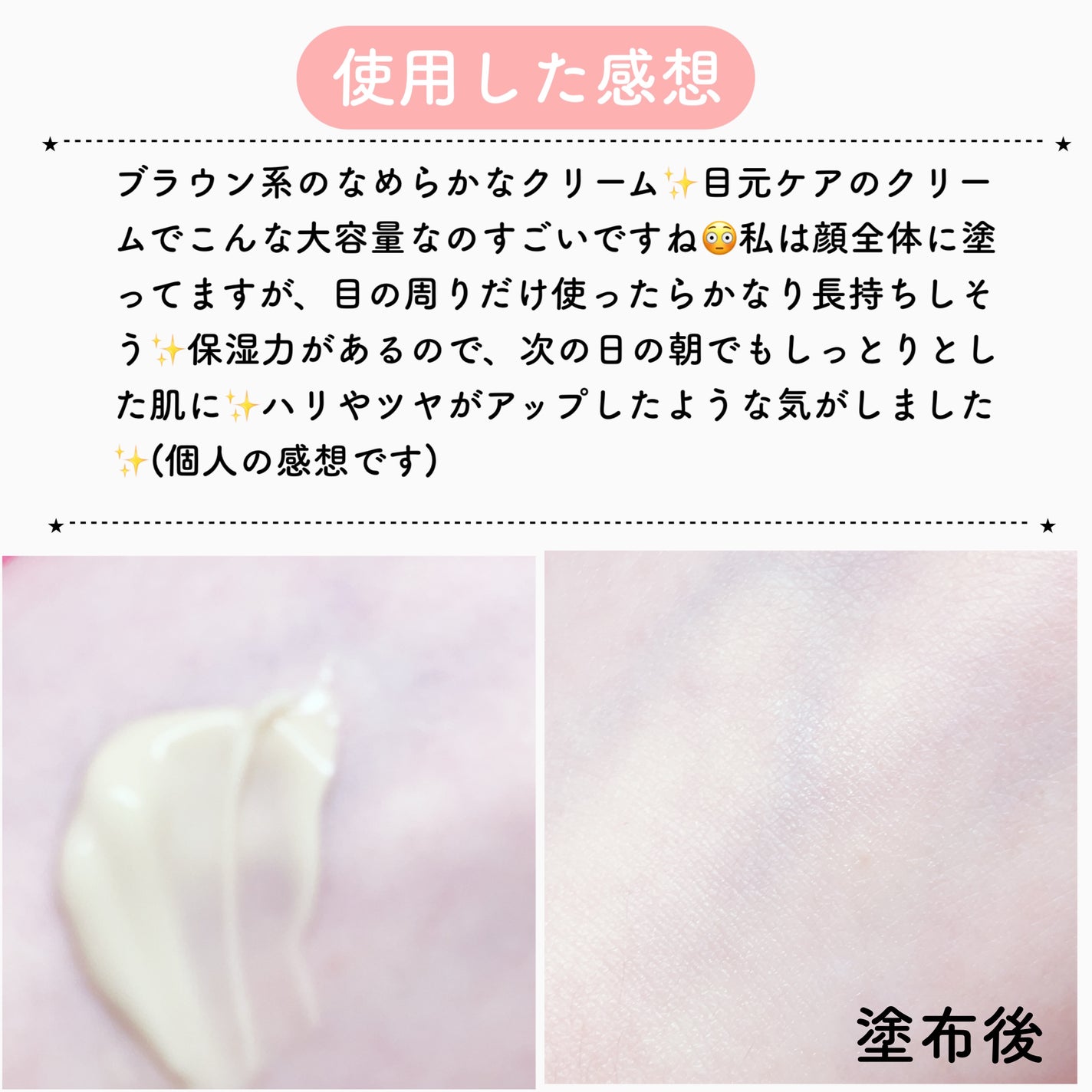 Cemenrete Calcium Intense Cream/Dr.Melaxin/フェイスクリームを使ったクチコミ(6枚目)