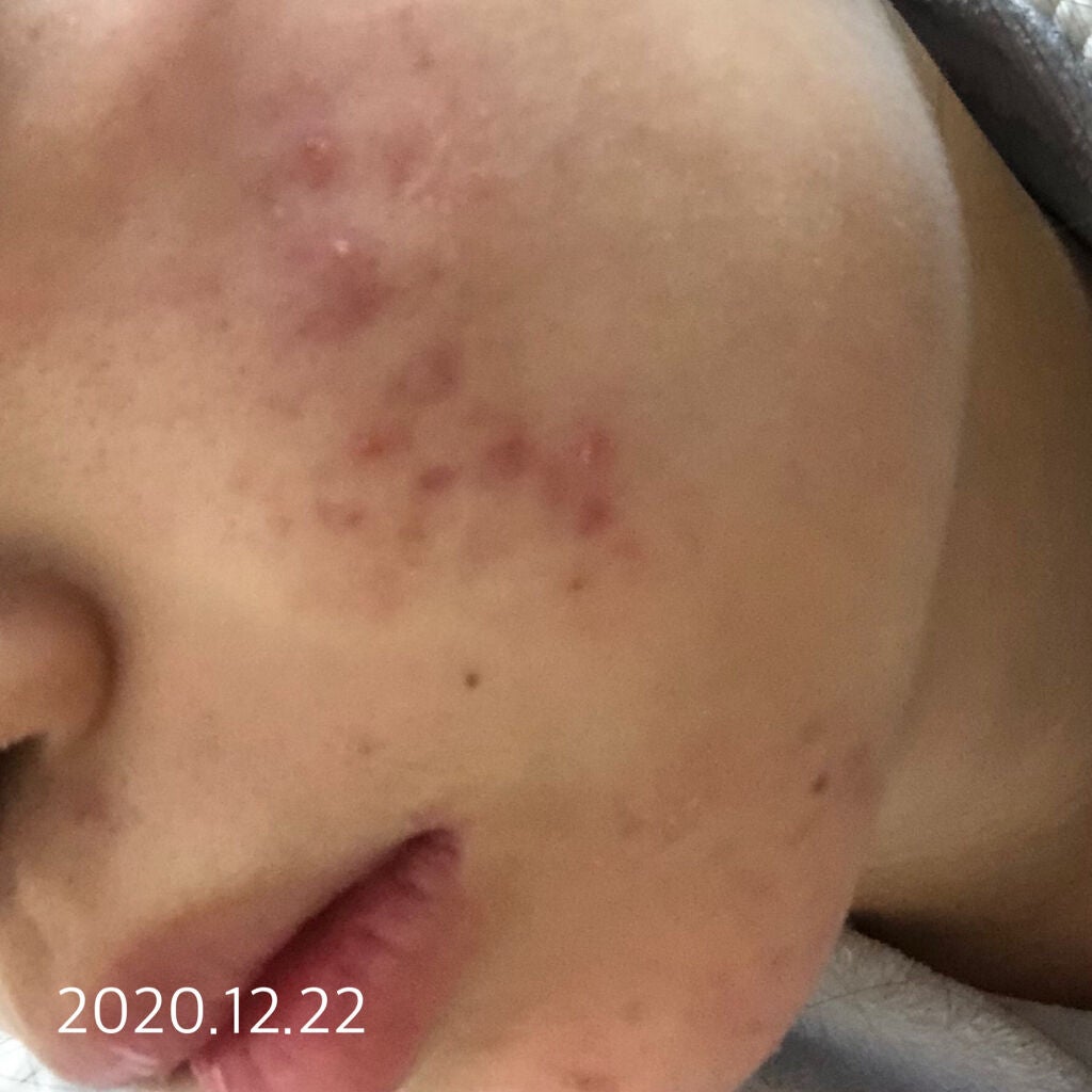 潤浸保湿 フェイスクリーム/キュレル/フェイスクリームを使ったクチコミ(2枚目)