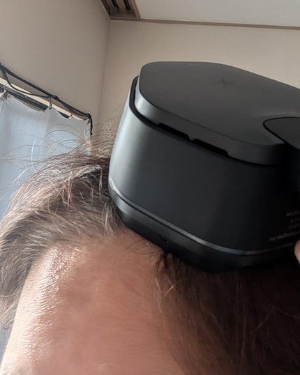 miki-nu on LIPS 「90日体験結果発表~♪紫外線も強烈高温多湿のジメジメ頭皮の髪悩..」(2枚目)