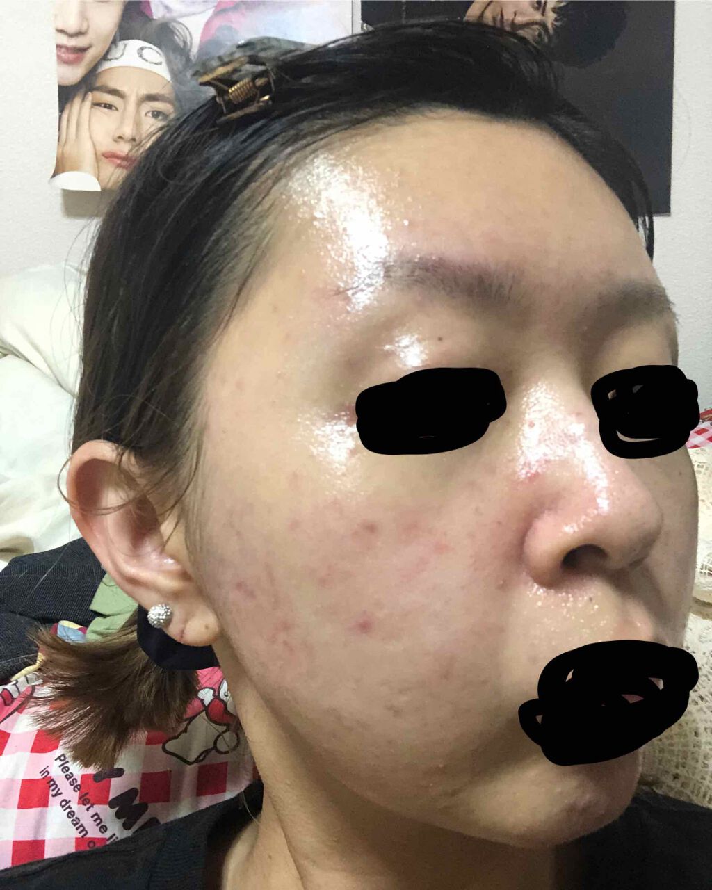 AC フェイスローション/NOV/化粧水を使ったクチコミ(2枚目)