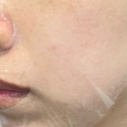 ティーツリーオイルパック/NOWATER/シートマスク・パックを使ったクチコミ(7枚目)