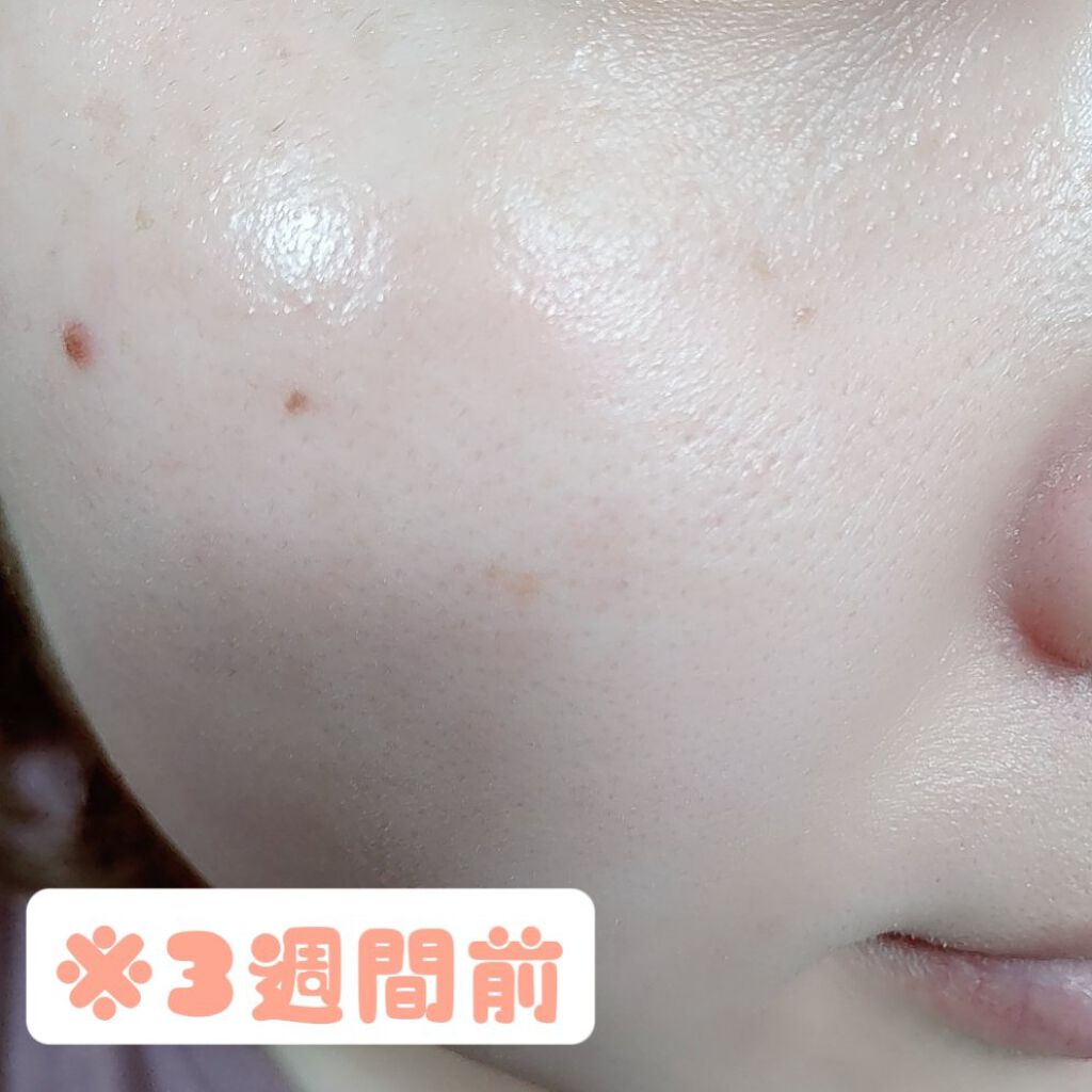 エクサージュホワイト ホワイトライズ ミルク/ALBION/乳液を使ったクチコミ（2枚目）