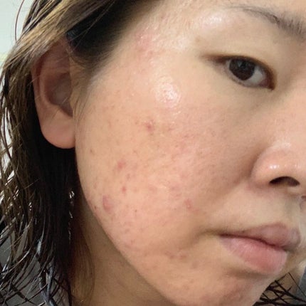 薬用しみ対策 美白化粧水 しっとりタイプ/メラノCC/化粧水を使ったクチコミ(4枚目)