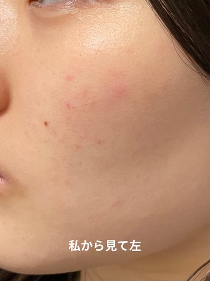 パンテノールシカブレミッシュアンプル/BIOHEAL BOH/美容液を使ったクチコミ(2枚目)