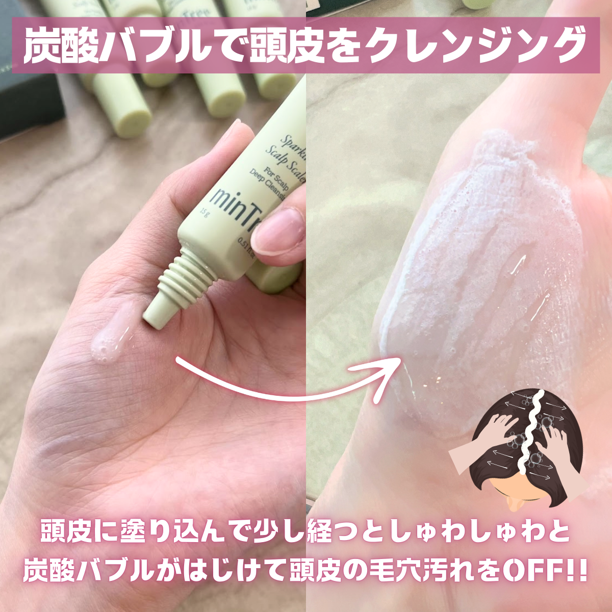 スパークリングスカルプスケーラー/ミンツリー/頭皮ケアを使ったクチコミ（3枚目）