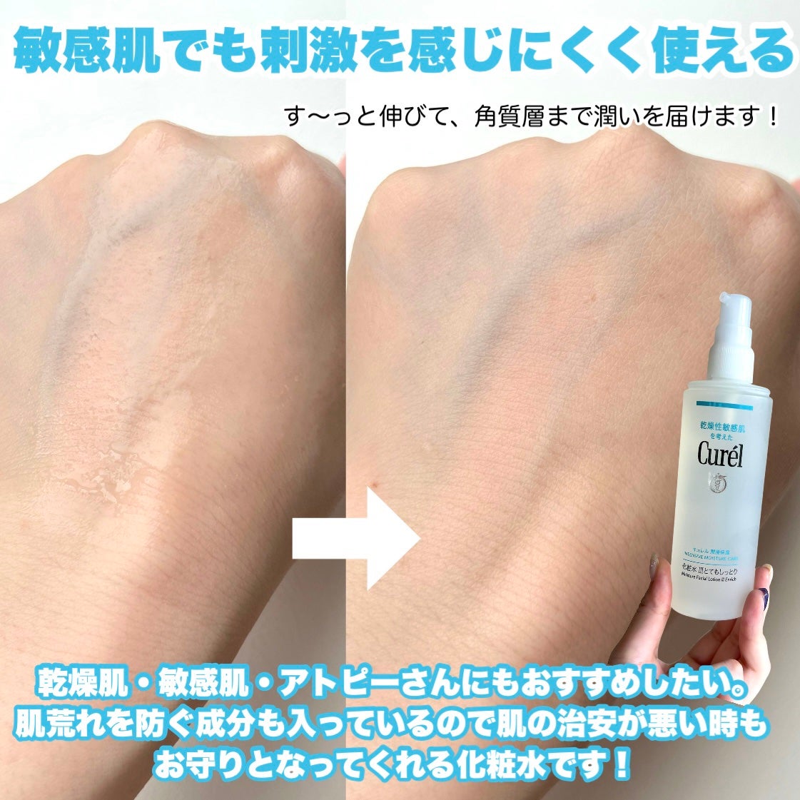 潤浸保湿 化粧水 III とてもしっとり/キュレル/化粧水を使ったクチコミ(4枚目)