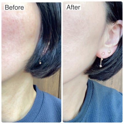 フローレス ルミエール ラディアンス パーフェクティング クッション/ローラ メルシエ/クッションファンデーションを使ったクチコミ(7枚目)