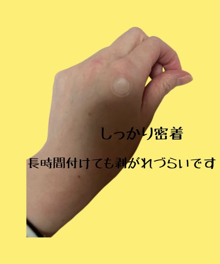 エーキュアショットスポットパッチ/obsero/にきびパッチを使ったクチコミ(3枚目)