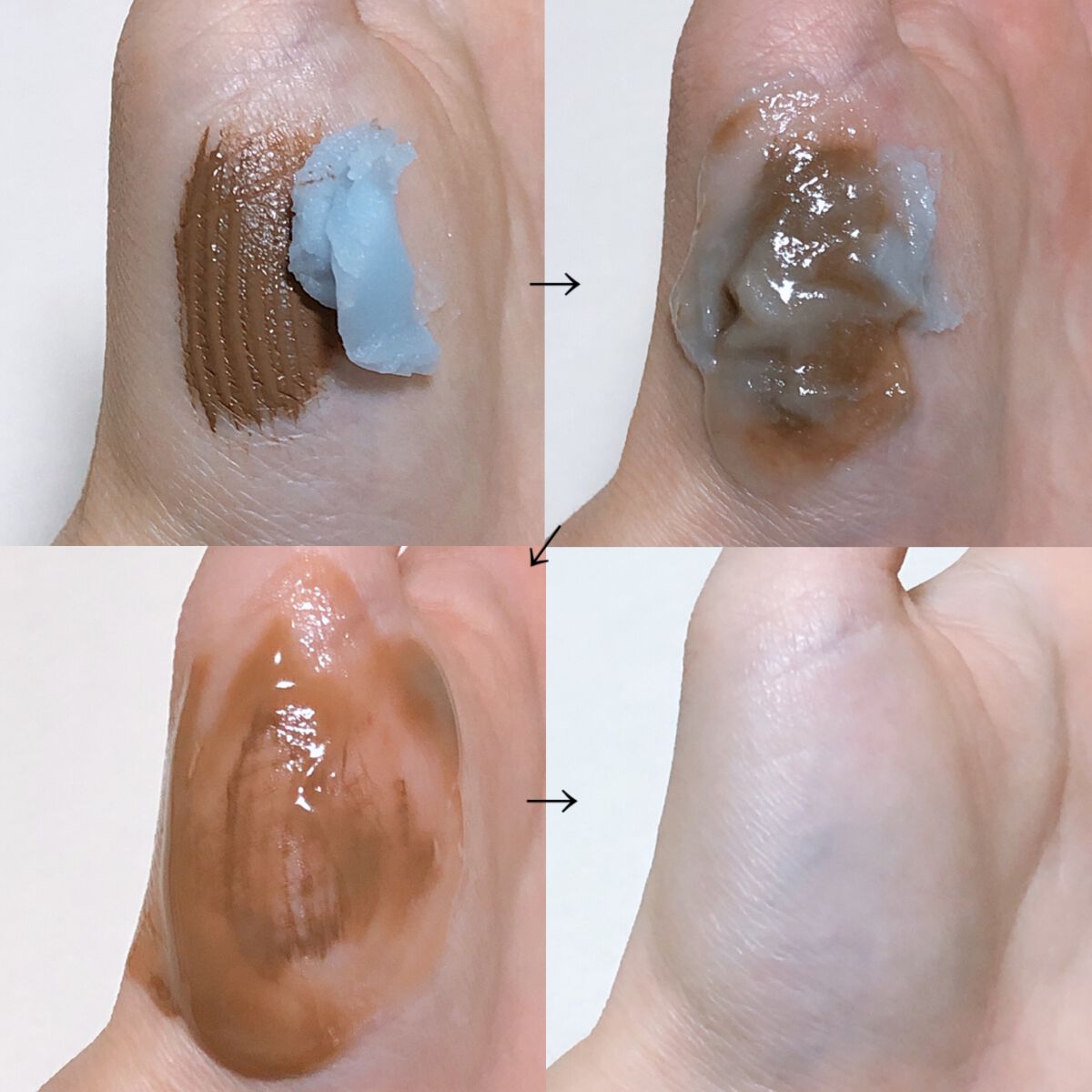 夢みるバーム アクネクリアモイスチャー/ロゼット/クレンジングバームを使ったクチコミ(7枚目)