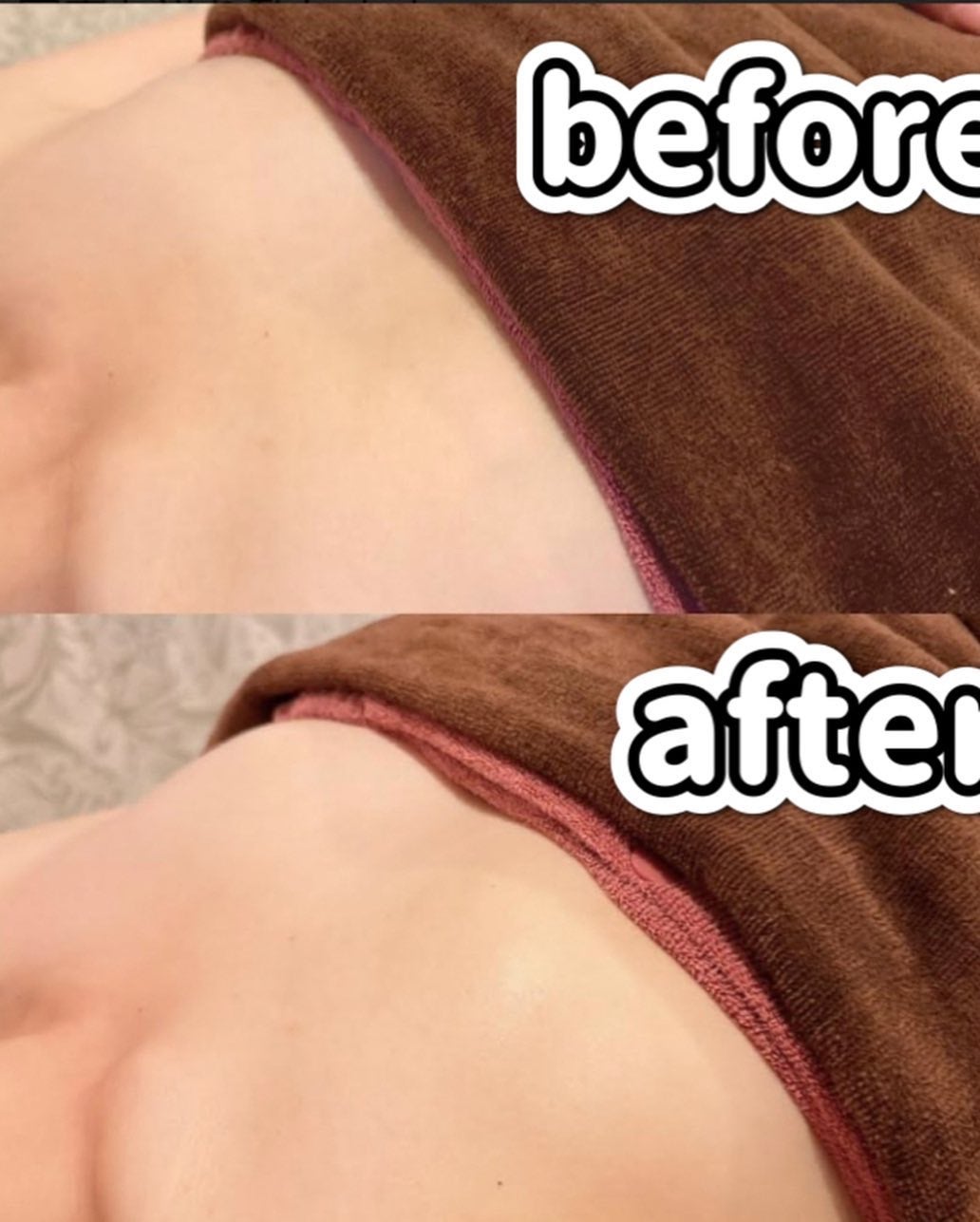 ふうせん @フォロバ100% on LIPS 「バストのお悩みならblossom!@blossom_kunit..」(6枚目)