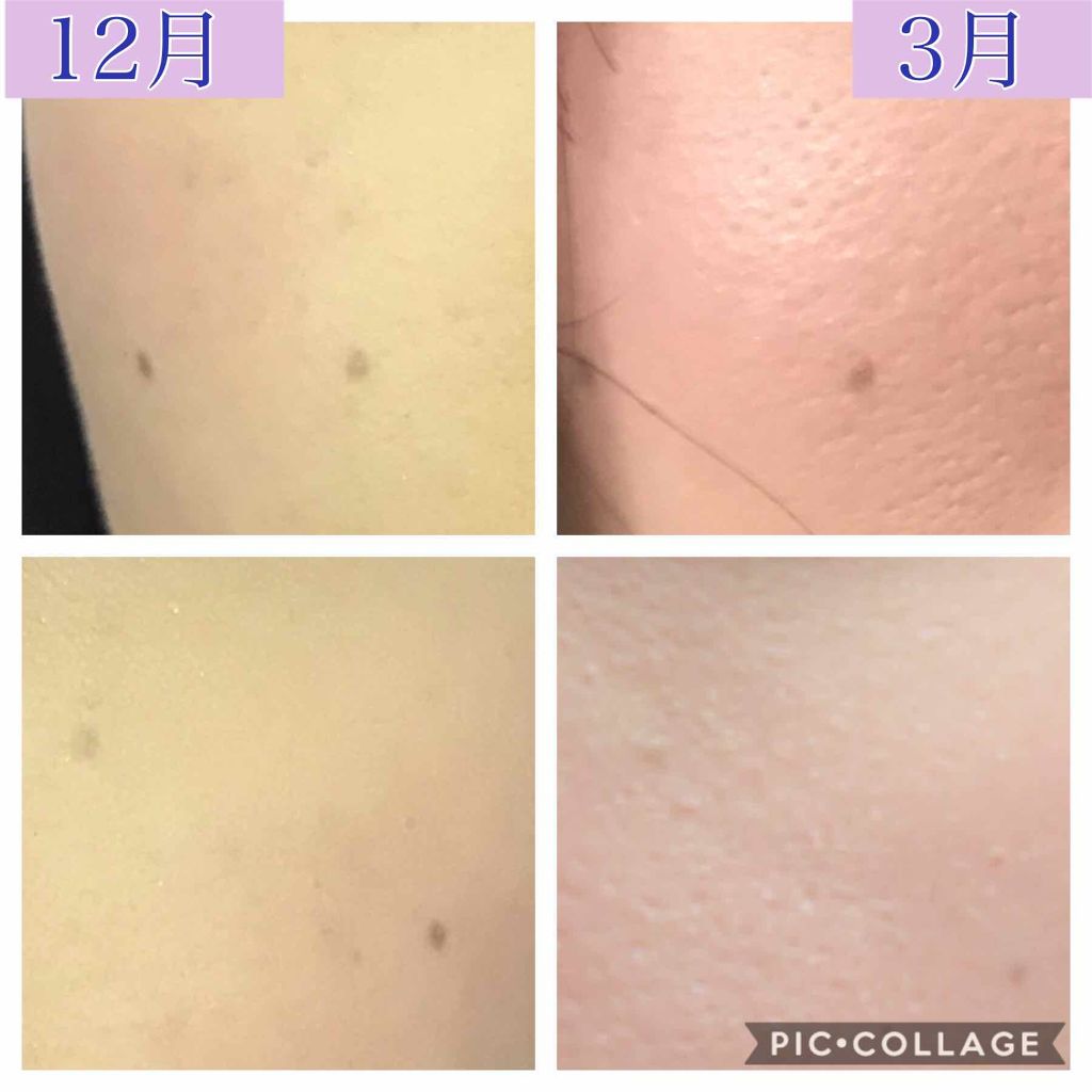 洗顔石鹸/ドモホルンリンクル/洗顔フォームを使ったクチコミ(3枚目)