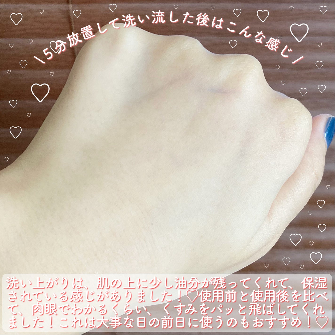 サナ なめらか本舗 もちもち濃パック/なめらか本舗/洗い流すパック・マスクを使ったクチコミ(5枚目)