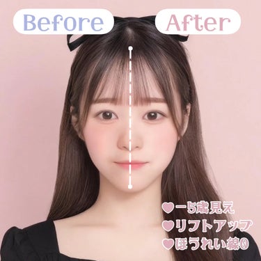 ADDICTION アディクション スキンリフレクト フィックス コンシーラーのクチコミ「\圧倒的小顔見えする🎀/コンシーラーの入れ方♡


こんにちは、苺鈴です🍓

今回は、海外でバ.....」（3枚目）