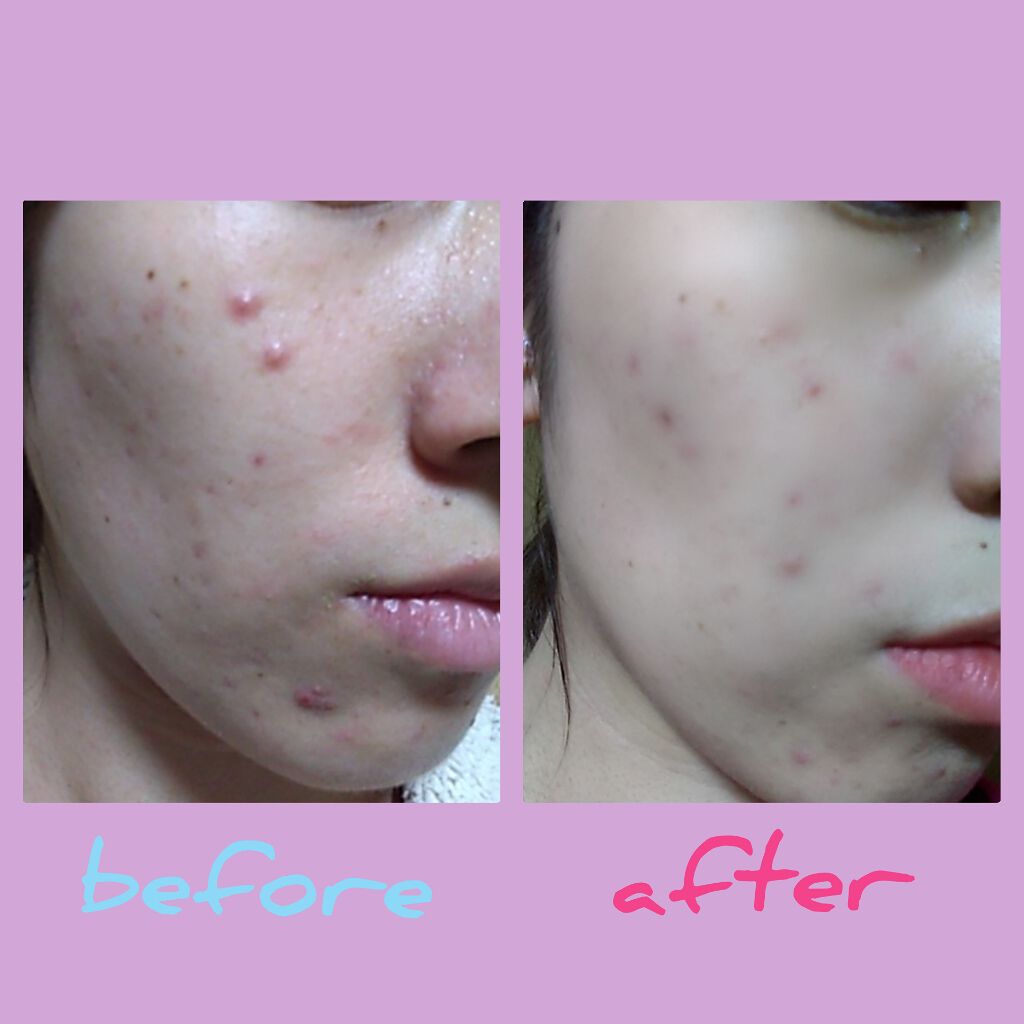 ブライトニングケア ローション M（医薬部外品）/アクアレーベル/化粧水を使ったクチコミ（3枚目）