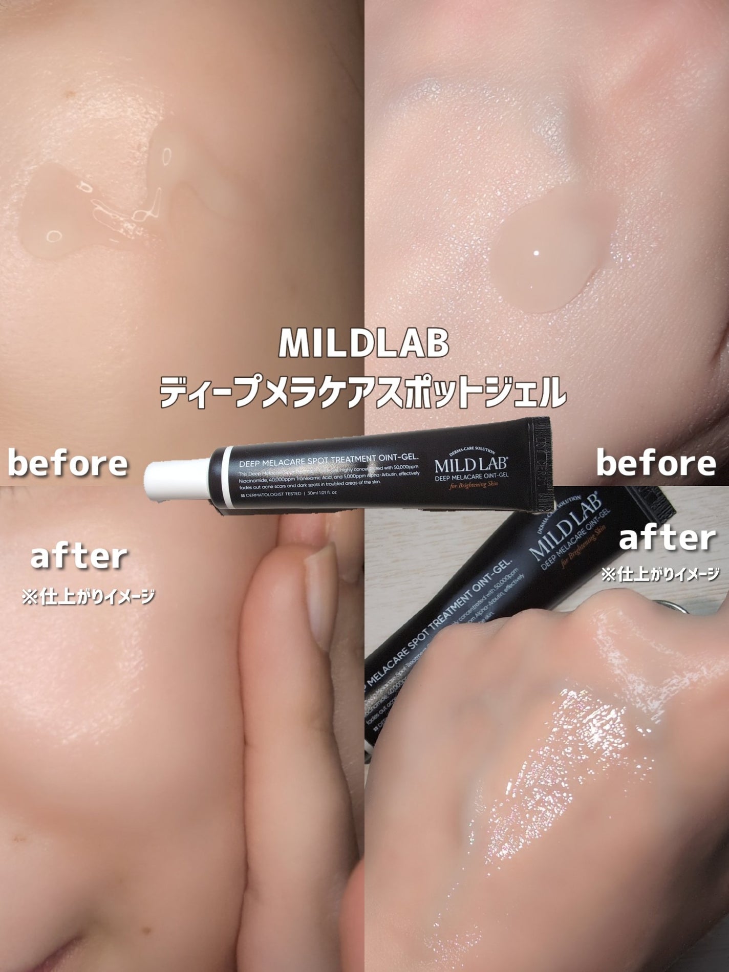 ディープ メラケア 美容液/Mildlab/美容液を使ったクチコミ(3枚目)