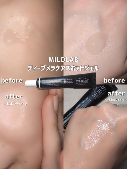ディープ メラケア 美容液/Mildlab/美容液を使ったクチコミ(3枚目)