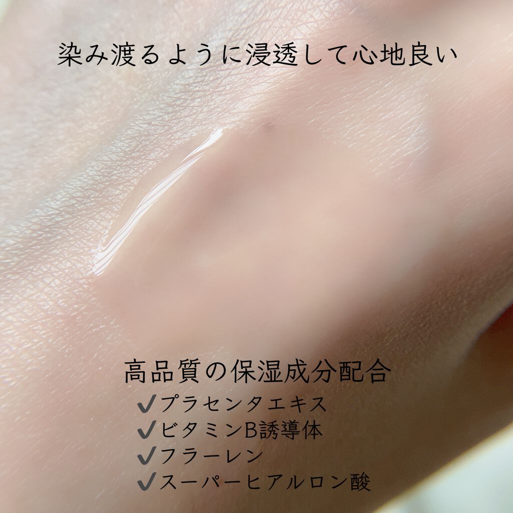 ヒト幹細胞美容液/idio/美容液を使ったクチコミ(5枚目)