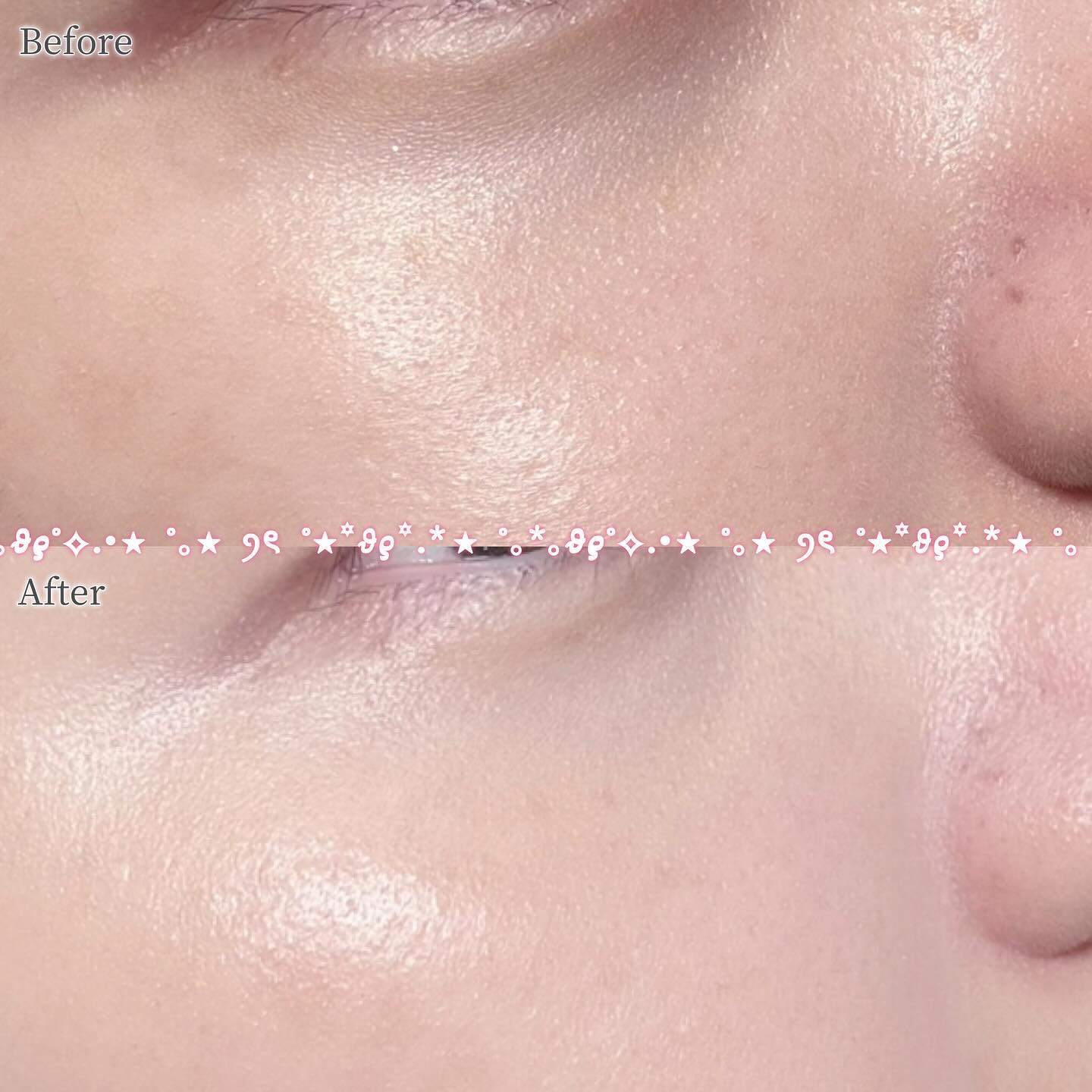 スキンレイヤーフィットファンデーション/ABOUT TONE/リキッドファンデーションを使ったクチコミ（3枚目）