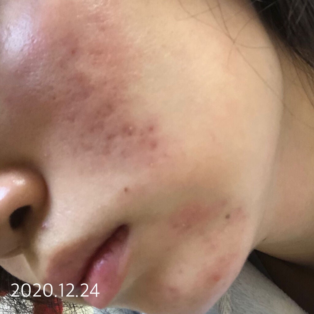 潤浸保湿 フェイスクリーム/キュレル/フェイスクリームを使ったクチコミ(3枚目)