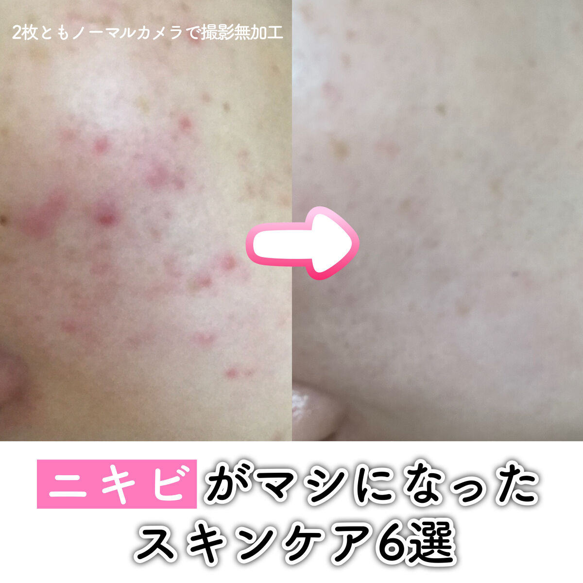 スキンケアクレンジング/パラドゥ/ミルククレンジングを使ったクチコミ（1枚目）