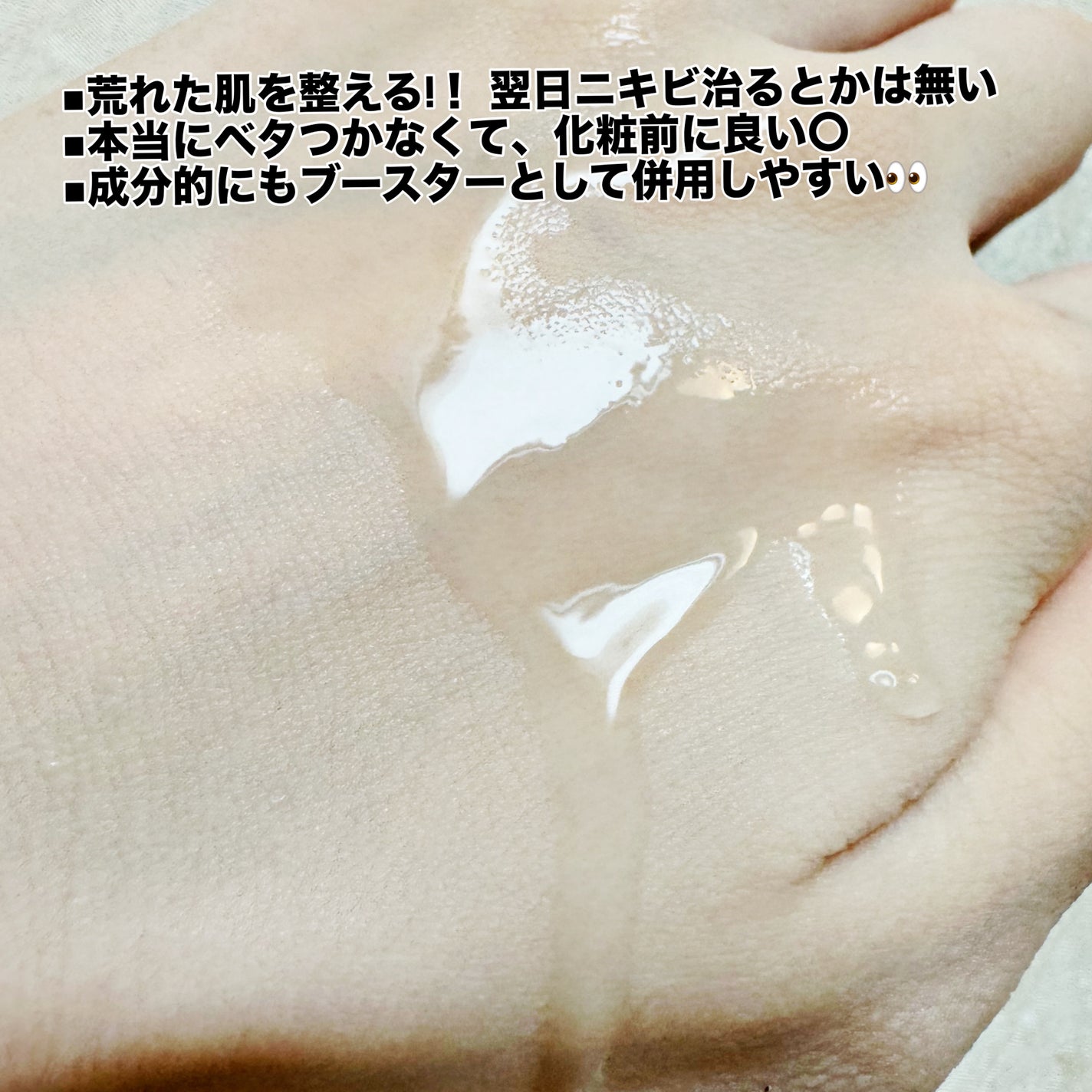 センテラ アンプル/SKIN1004/美容液を使ったクチコミ(4枚目)