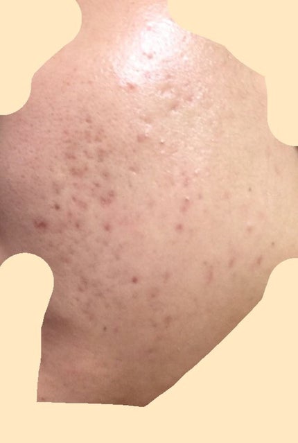 白潤 薬用美白化粧水/肌ラボ/化粧水を使ったクチコミ(2枚目)