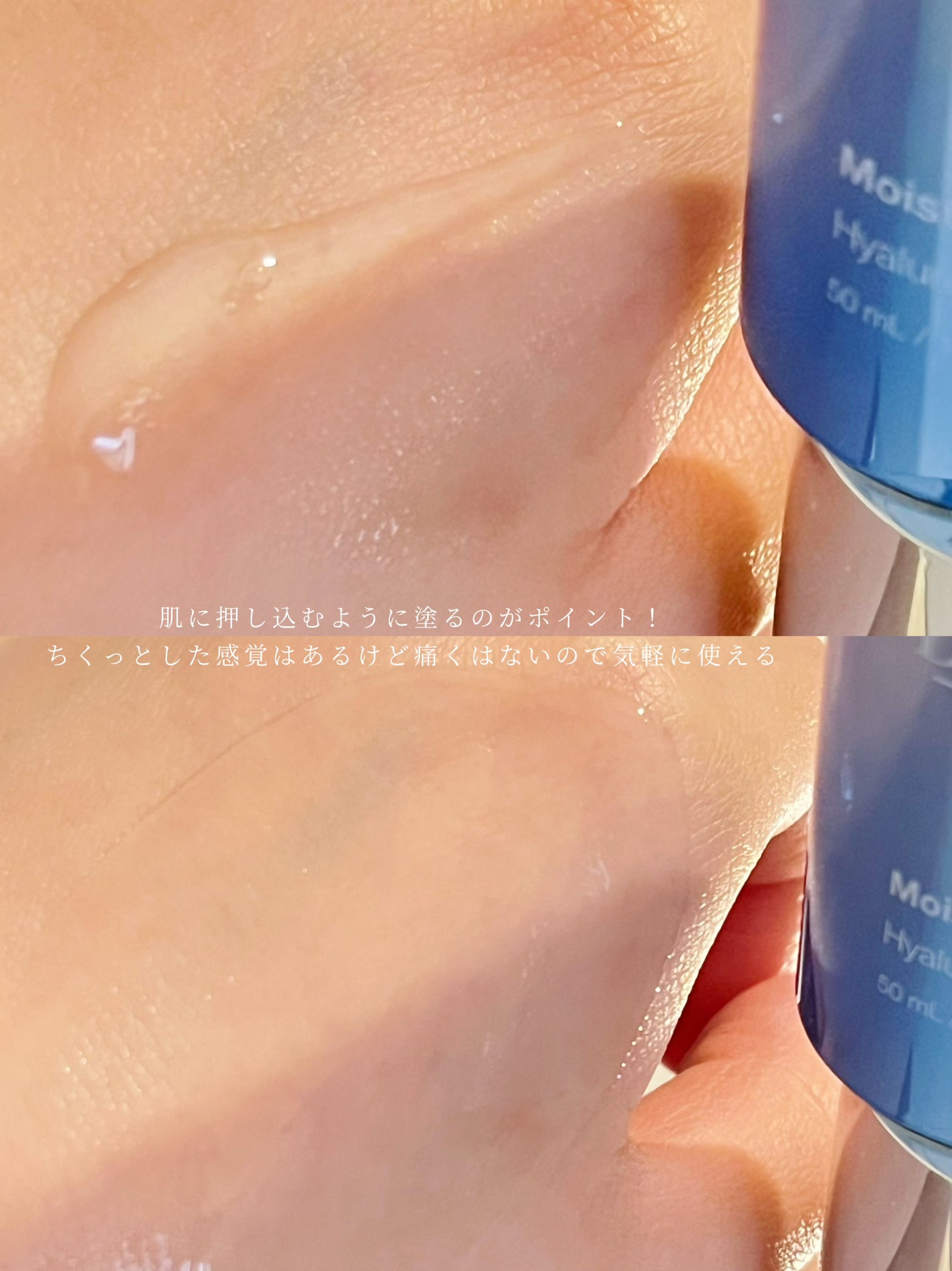 RTXセラム ヒアルショット/Dr.G/美容液を使ったクチコミ(4枚目)